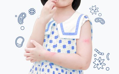 Kako probiotici pomažu kada se javi ekcem?