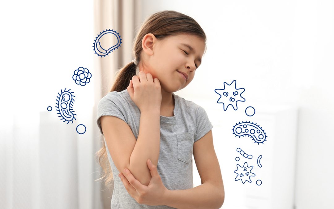 Ekcem i stres: Da li postoji veza?